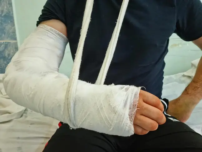 Пловдивчанин сряза ръката си, ортопеди я спасиха от ампутация