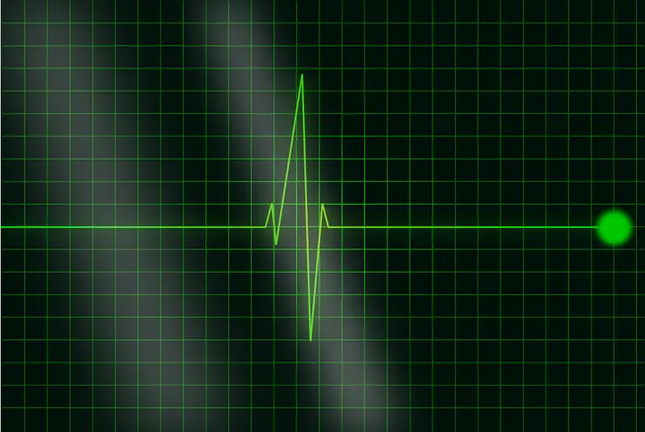Безплатни кардиологични прегледи в ИСУЛ по повод Световния ден на сърцето