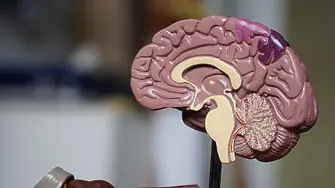 В мозъка на починали от Ковид-19 са открити промени като при Алцхаймер