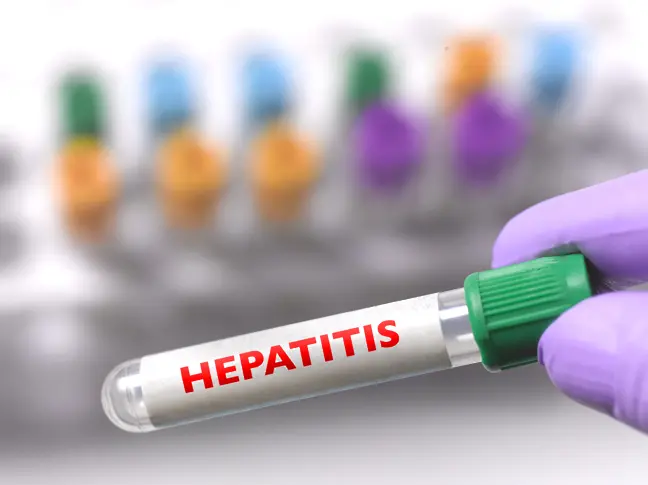 22 случая на остър хепатит в Испания