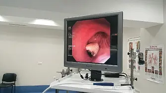 Лекари извадиха зъбна коронка от дихателните пътища на мъж след 6 месеца