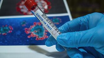 177 са новите случаи на коронавирус, регистрирани в област Хасково