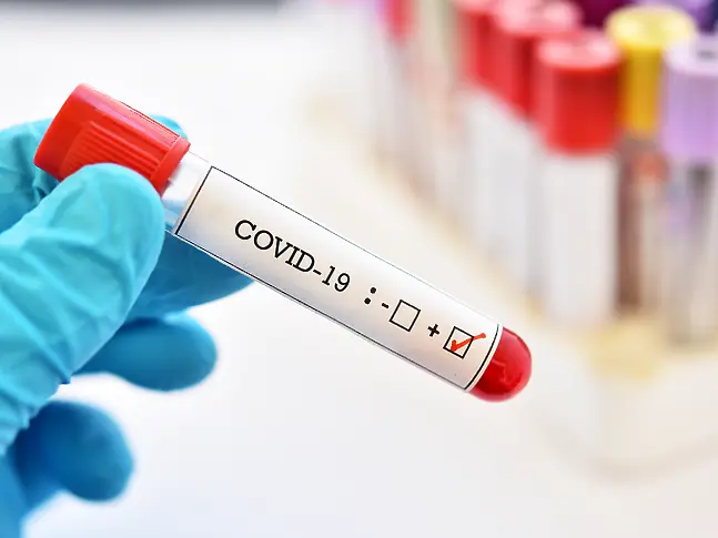 84 нови с коронавирус в област Хасково