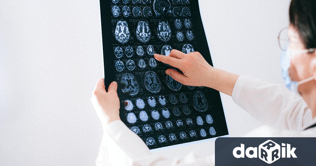 Части от човешка мозъчна тъкан са трансплантирани в мозъците на