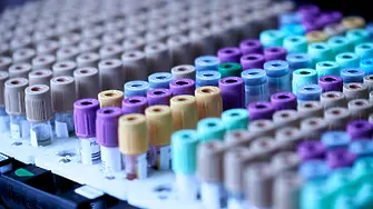 В 8 лаборатории ще се правят кръвни тестове за наркотици на шофьорите