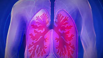 Проф. Феликс Херт: Въвеждането на биологични продукти е обещаващо решение за пациенти с тежка астма