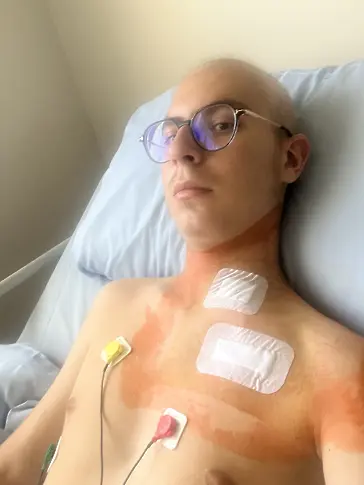  Зов за помощ: 18-годишният Крис се нуждае от средства, с цел да избави живота си 