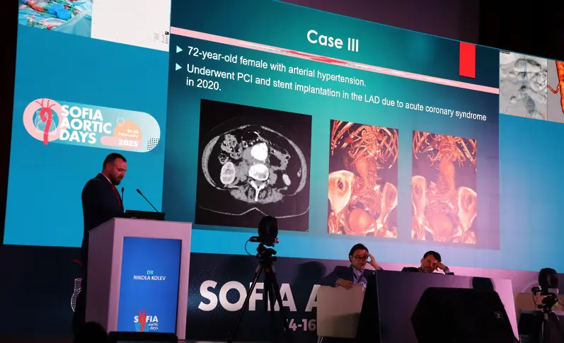  Проф. Кузман Гиров: Българите не обичаме да вървим на доктор и случаите се хващат, когато са доста напреднали 