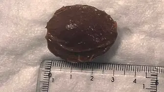 Костилка от кайсия блокира хранопровода на мъж, спасен е след бърза лекарска намеса