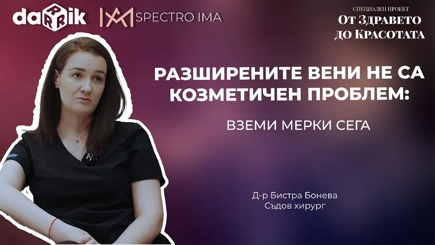 Разширените вени: Митове, съвременно лечение и как да надвием гените