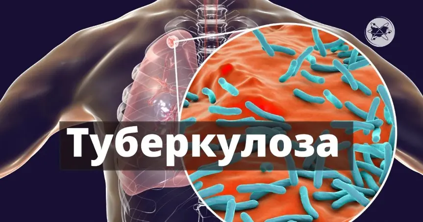 Седмица на отворените врати за ранно откриване на туберкулоза в област Габрово