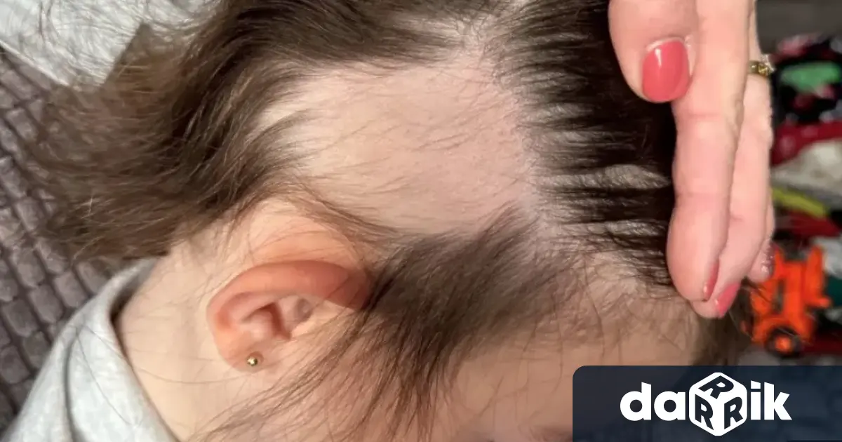 Майка чиято 3 годишна дъщеря е била оскубана от електрическа четка