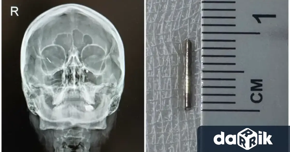 Изключителен медицински случай в столичната УМБАЛ Александровска завърши с щастлив