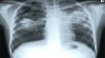 8-ми ноември е Международен ден на образната диагностика