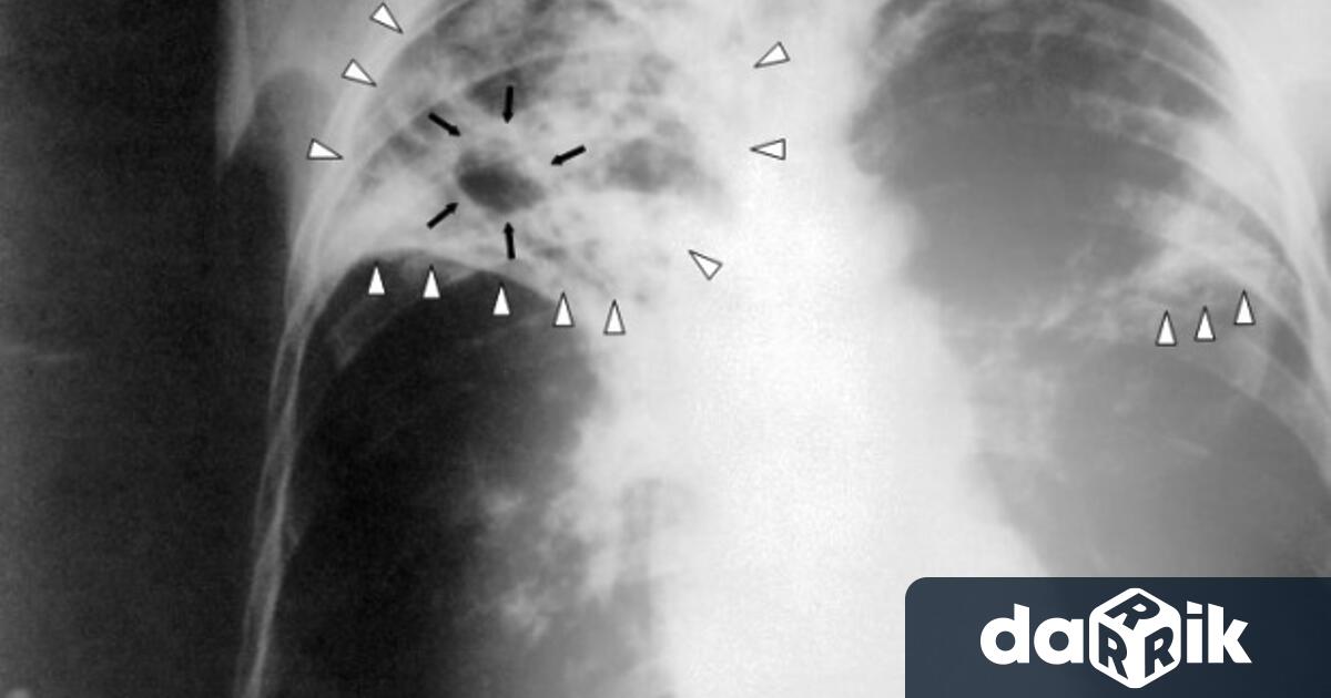 12 ти ноември е международен ден за борба с пневмонията Отбелязва