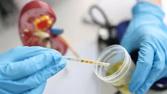 МБАЛ "Д-р Иван Селимински" обяви инициатива за измерване на кръвна захар