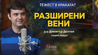 Разширените вени: Проблем, чието решение не бива да отлагаме