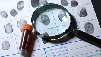 След смъртта на млада жена след поставяне на хиалурон : Разследват обстоятелствата