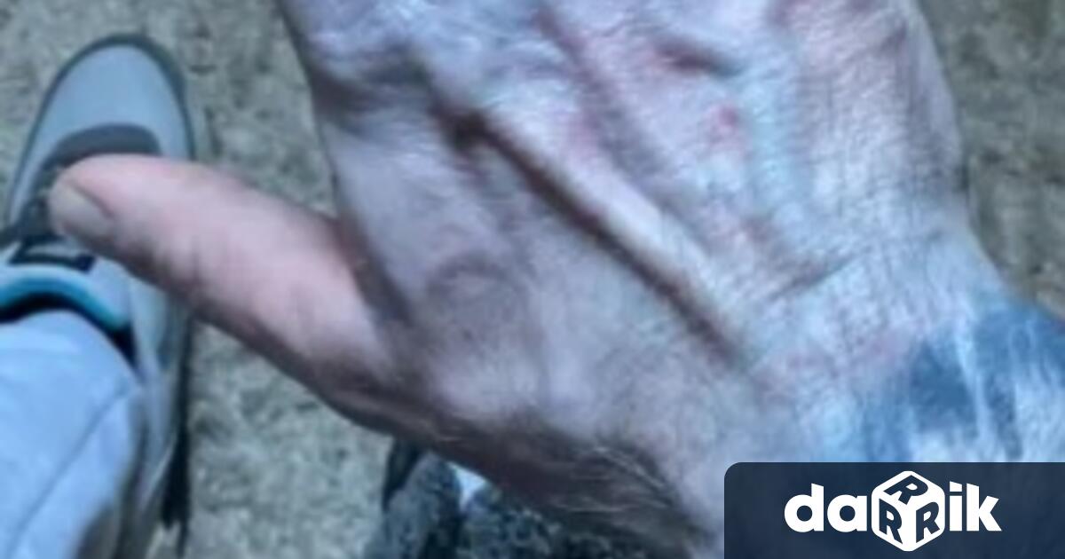 Мъж бе откаран спешно в болница след като кожата му