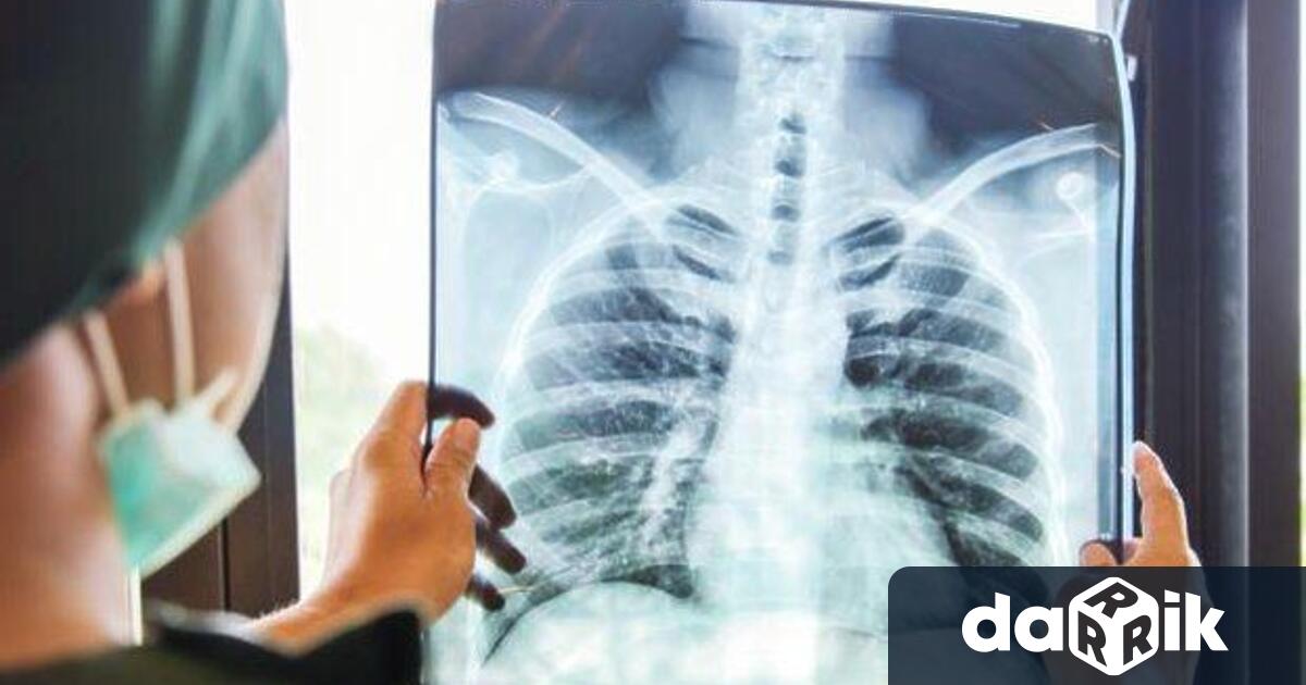 Седмица на отворените врати за безплатни прегледи за туберкулоза ще