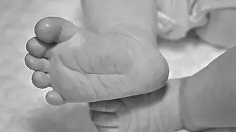 18-годишен хапал лицето на бебе, докато не заприличало на „счупено яйце“